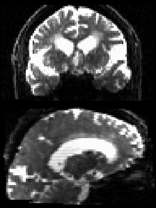 Movie of sample points on the whole-sphere