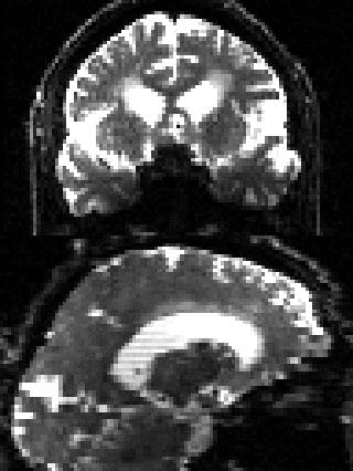 Movie of data before any correction.