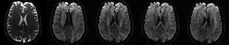 Example of b0 and four dwis