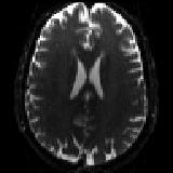 Example of b0 with reversed PE.