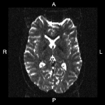 A->P SE-EPI image