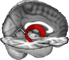 Fornix FMRIB FA 1mm schematic