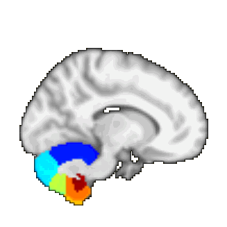 Probabilistic cerebellar  atlas