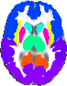 MNI structural atlas