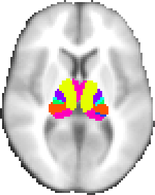 Oxford thalamic connectivity atlas