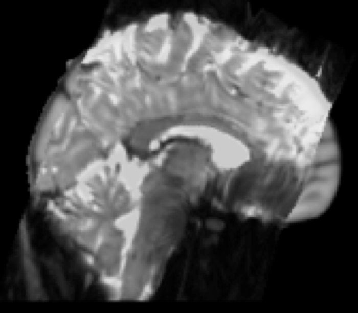 FMRI to Standard Space Example