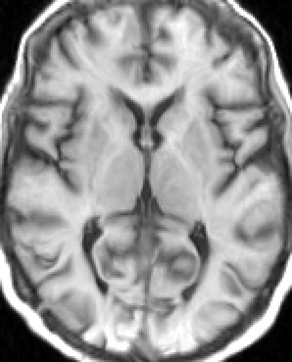 warped image little regularisation