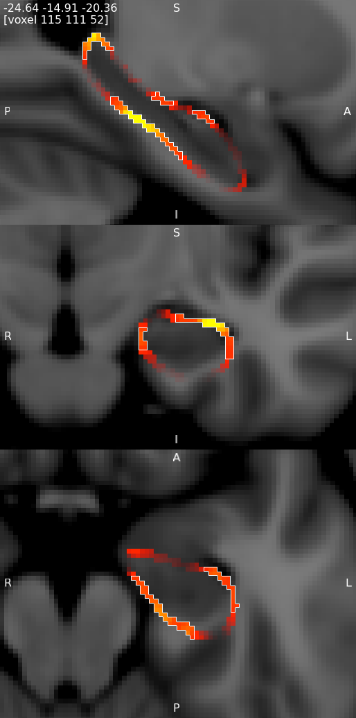 Viewing FIRST results with the FSLeyes ortho view