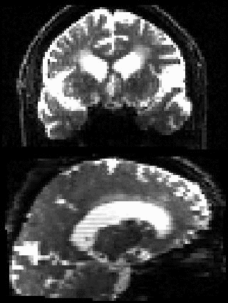 Movie of sample points on the half-sphere