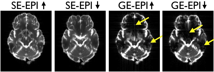 GE-EPI vs SE-EPI