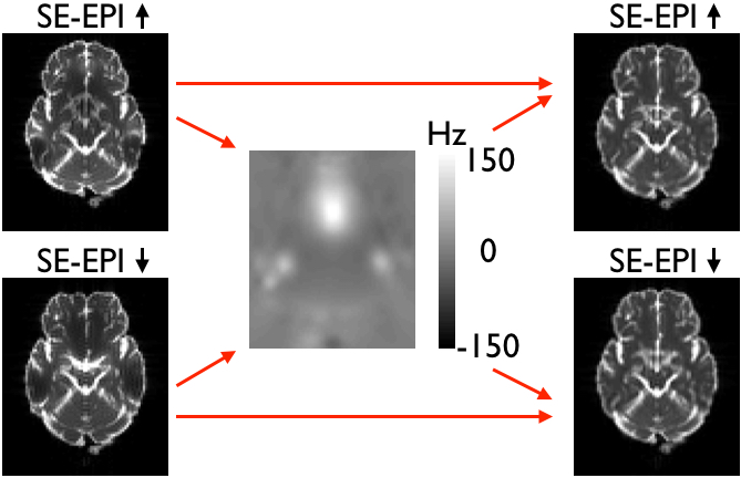Field estimated from SE-EPI pair