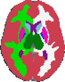 Harvard-Oxford subcortical atlas