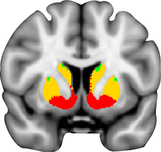 Oxford-GSK-Imanova striatal atlas