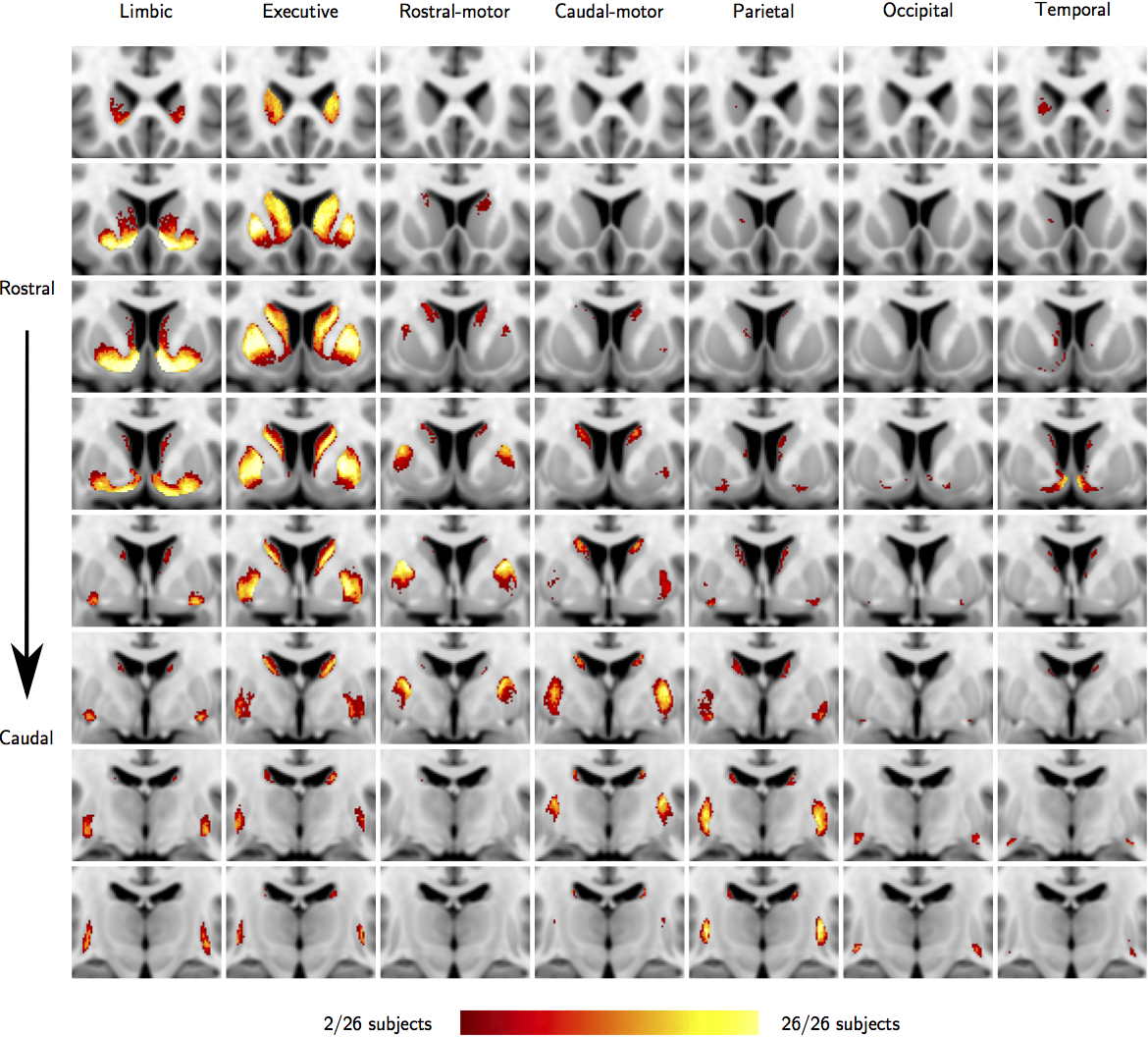 The striatum-con-prob-thr50 atlas