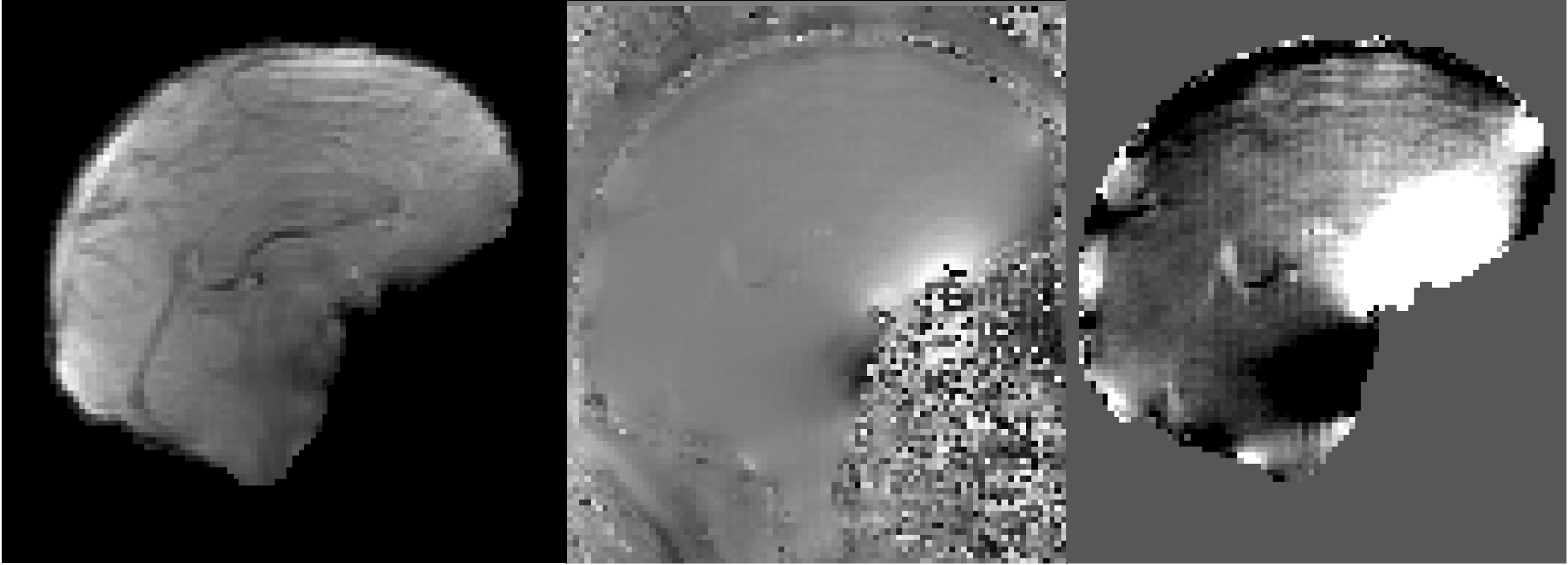 Example of Fieldmaps