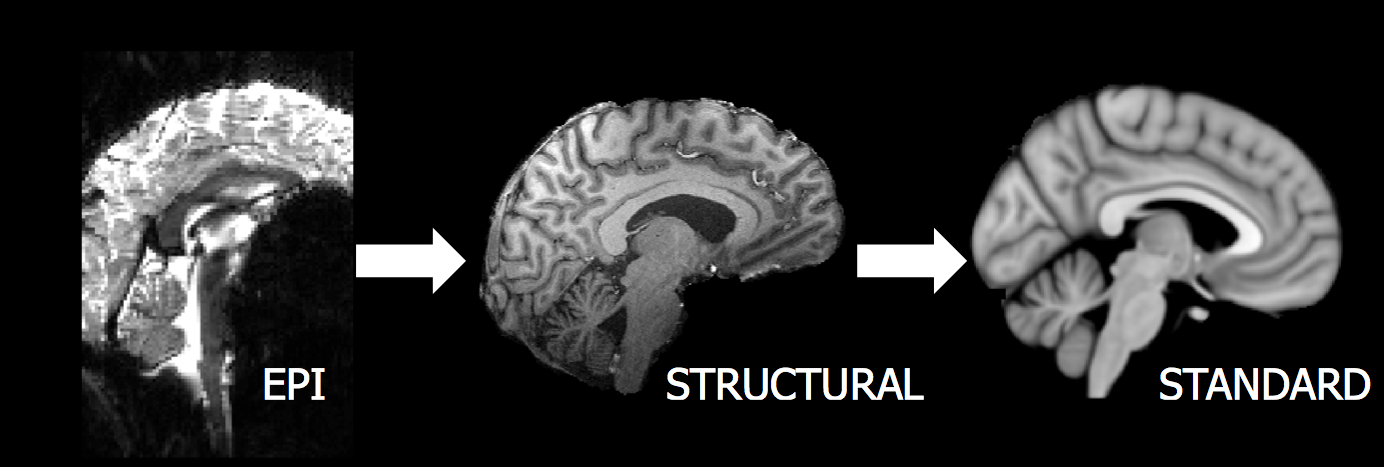 Example of Two Stage Registration