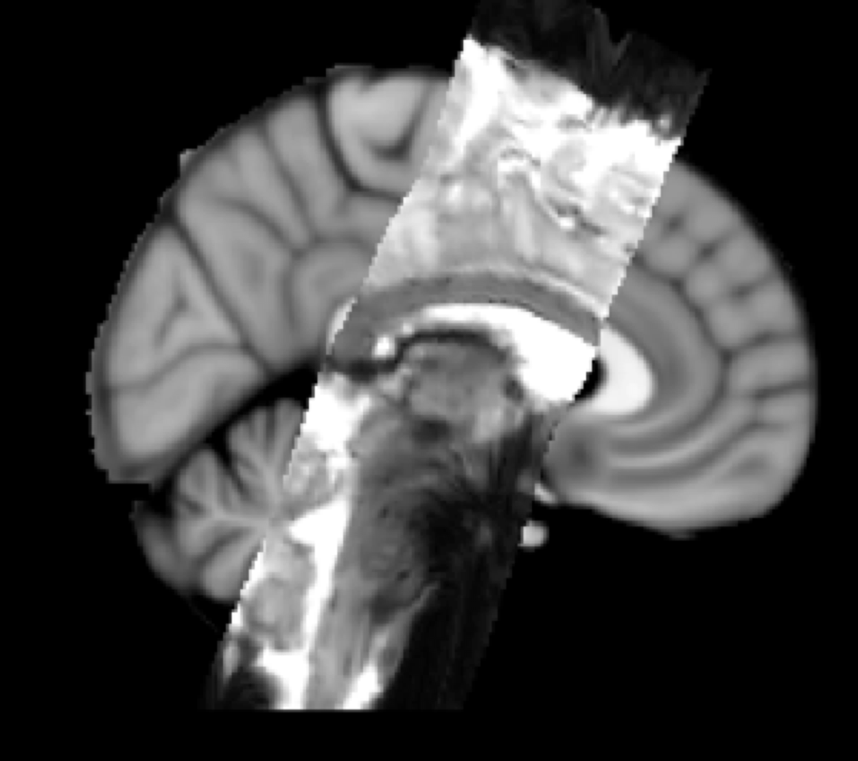 Partial FOV to Standard Space Example