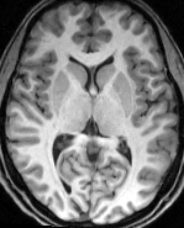 linear registered bias image