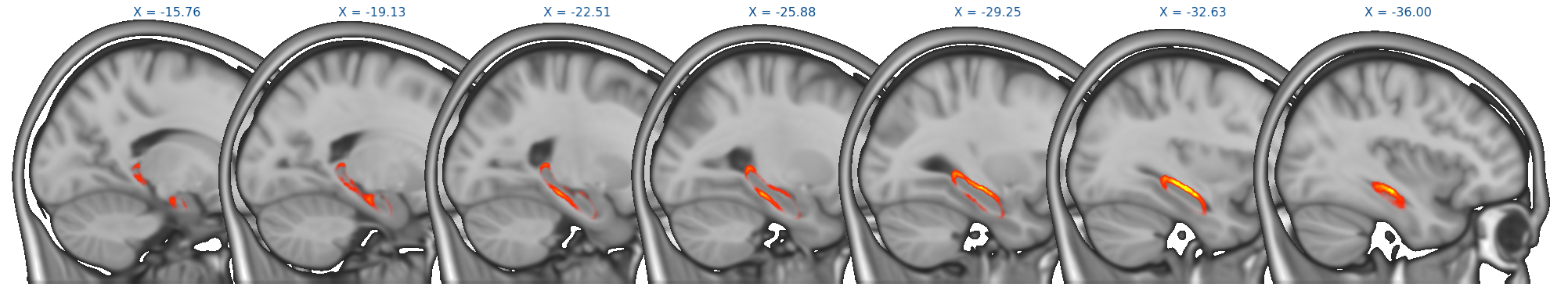 Viewing FIRST results with the FSLeyes lightbox view