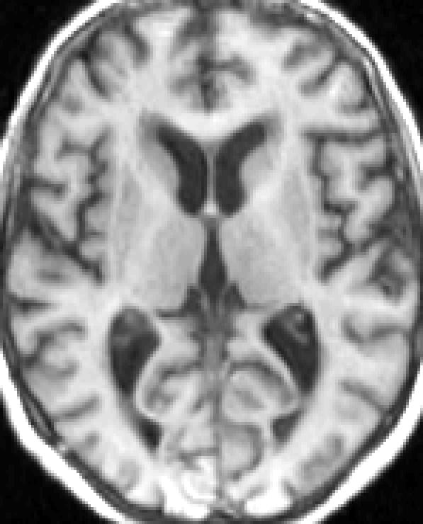 linearly registered image